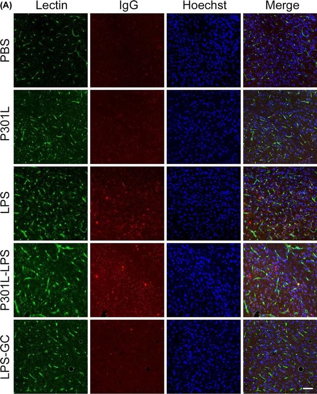 Mouse IgG (H+L) Highly Cross-Adsorbed Secondary Antibody in Immunohistochemistry (PFA fixed) (IHC (PFA))