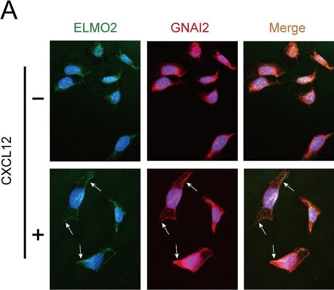 Mouse IgG (H+L) Highly Cross-Adsorbed Secondary Antibody in Immunocytochemistry (ICC/IF)