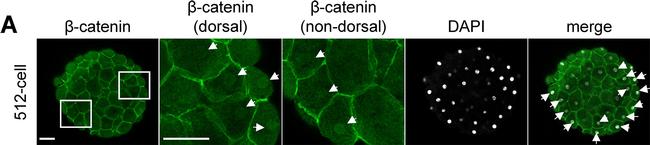 Mouse IgG (H+L) Cross-Adsorbed Secondary Antibody in Immunohistochemistry (IHC)