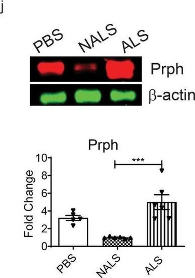 Mouse IgG (H+L) Cross-Adsorbed Secondary Antibody in Western Blot (WB)