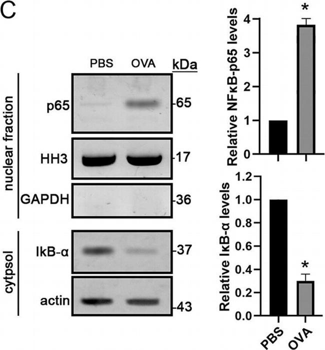 Rabbit IgG (H+L) Cross-Adsorbed Secondary Antibody in Western Blot (WB)