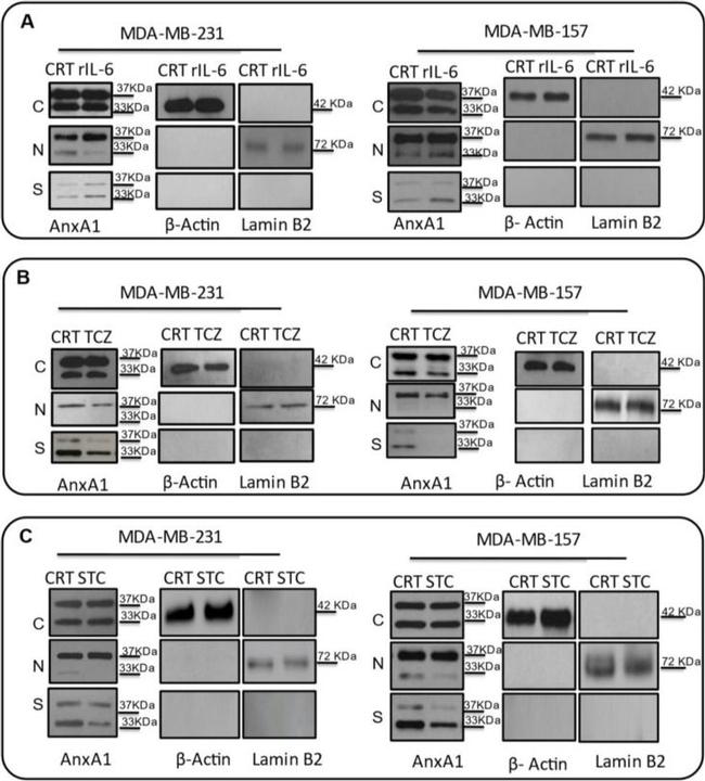 Rabbit IgG (H+L) Cross-Adsorbed Secondary Antibody in Western Blot (WB)