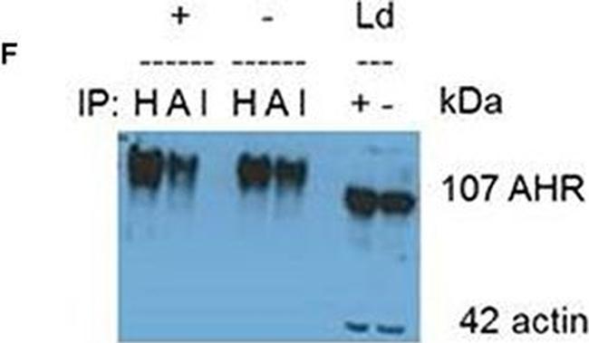 Armenian Hamster IgG Isotype Control in Immunoprecipitation (IP)