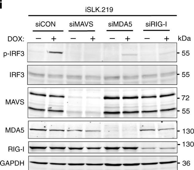 Rabbit IgG (Heavy Chain) Secondary Antibody in Western Blot (WB)