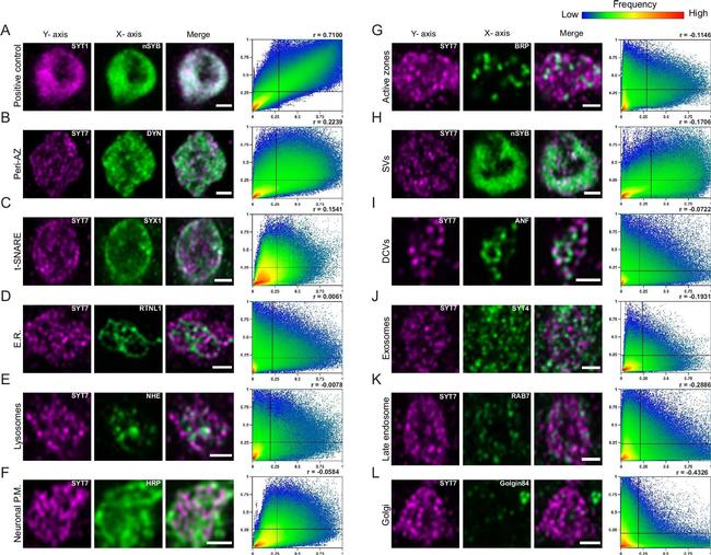 Mouse IgG (H+L) Highly Cross-Adsorbed Secondary Antibody in Immunocytochemistry (ICC/IF)