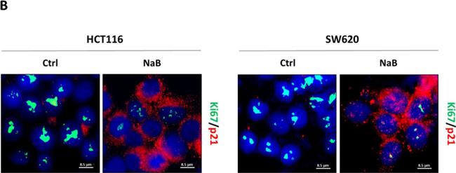 Rabbit IgG (H+L) Highly Cross-Adsorbed Secondary Antibody in Immunocytochemistry (ICC/IF)