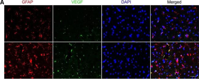 Rabbit IgG (H+L) Highly Cross-Adsorbed Secondary Antibody in Immunohistochemistry (Frozen) (IHC (F))