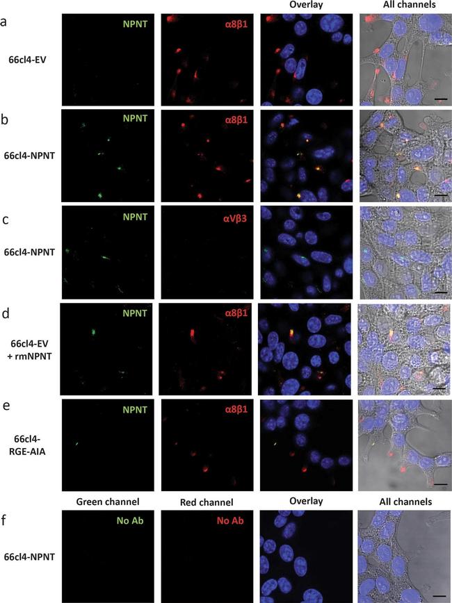 Mouse IgG (H+L) Highly Cross-Adsorbed Secondary Antibody in Immunocytochemistry (ICC/IF)