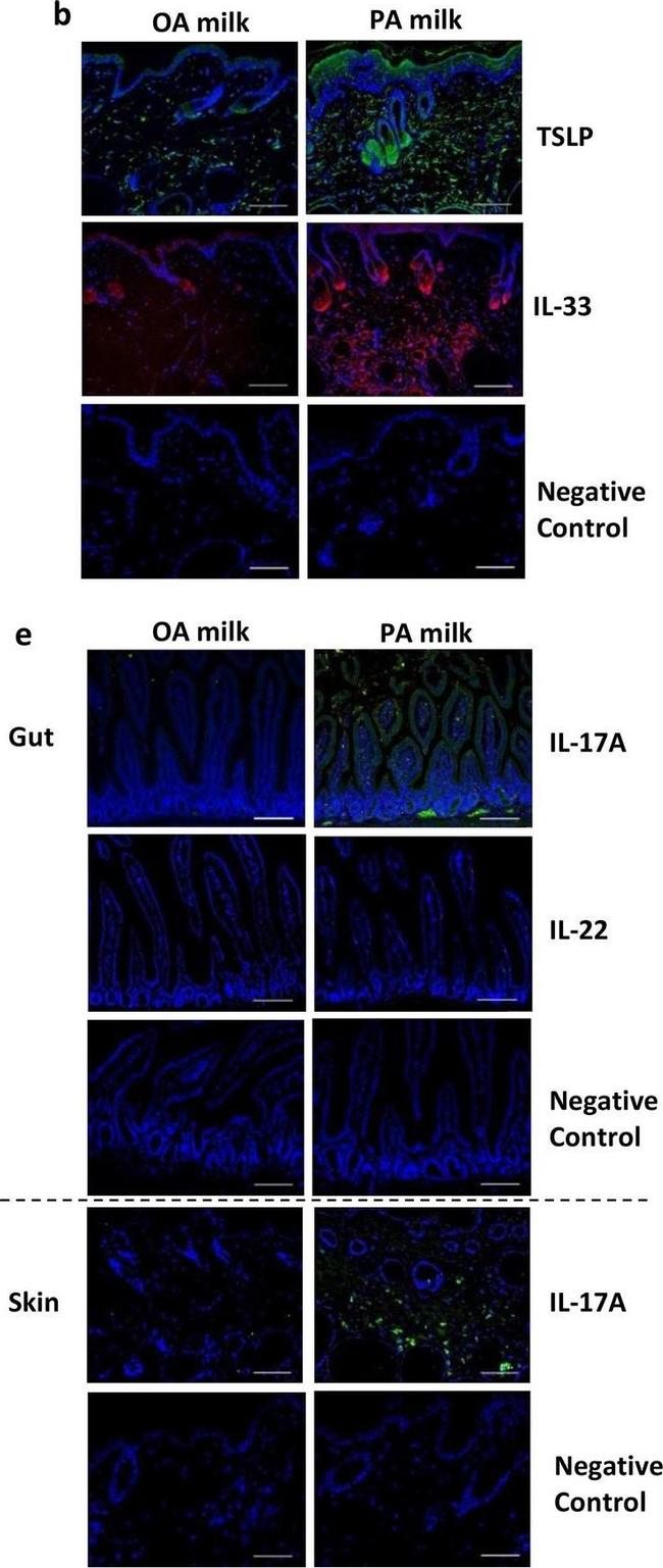 Rabbit IgG (H+L) Highly Cross-Adsorbed Secondary Antibody in Immunohistochemistry (IHC)