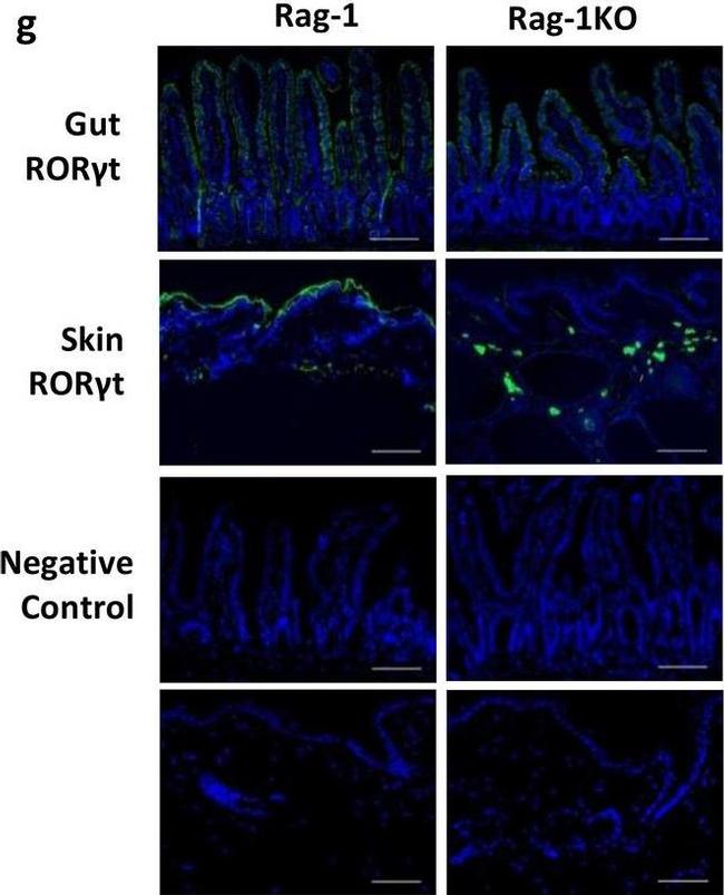 Rabbit IgG (H+L) Highly Cross-Adsorbed Secondary Antibody in Immunohistochemistry (IHC)