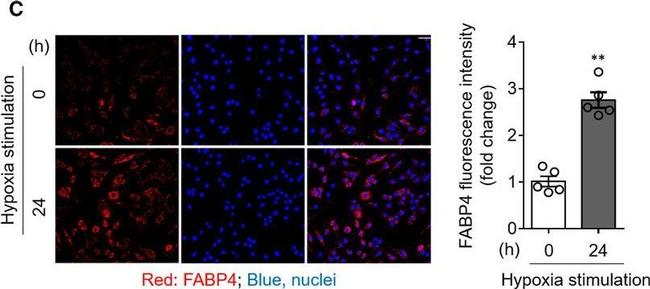 Rabbit IgG (H+L) Highly Cross-Adsorbed Secondary Antibody in Immunocytochemistry (ICC/IF)