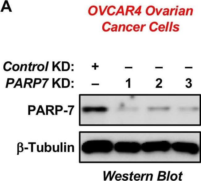 Rabbit IgG (H+L) Secondary Antibody in Western Blot (WB)