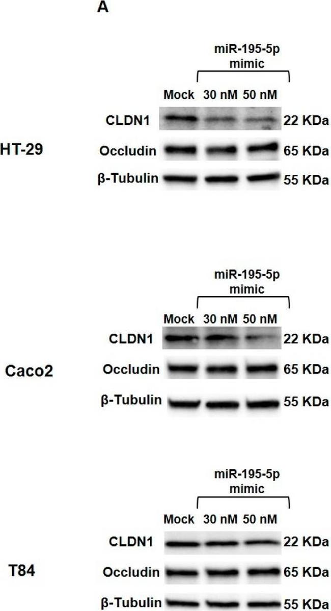 Rabbit IgG (H+L) Secondary Antibody in Western Blot (WB)