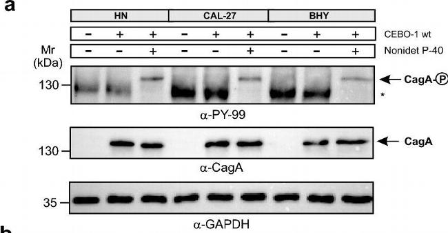 Rabbit IgG (H+L) Cross-Adsorbed Secondary Antibody in Western Blot (WB)