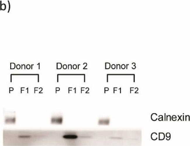 Mouse IgG (H+L) Secondary Antibody in Western Blot (WB)