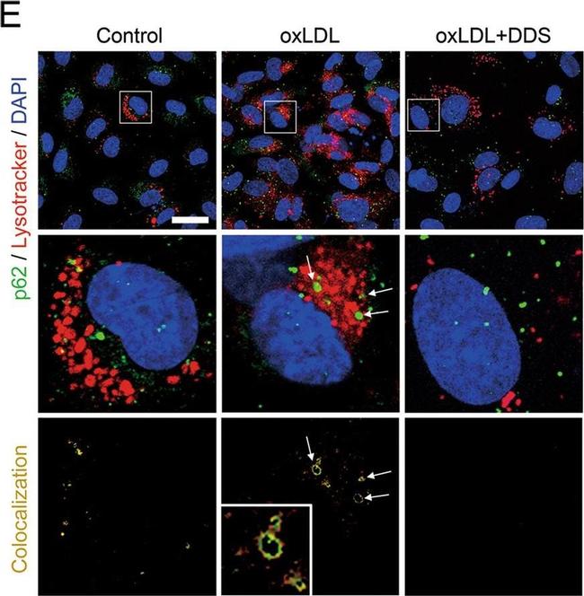 Rabbit IgG (H+L) Cross-Adsorbed Secondary Antibody in Immunocytochemistry (ICC/IF)