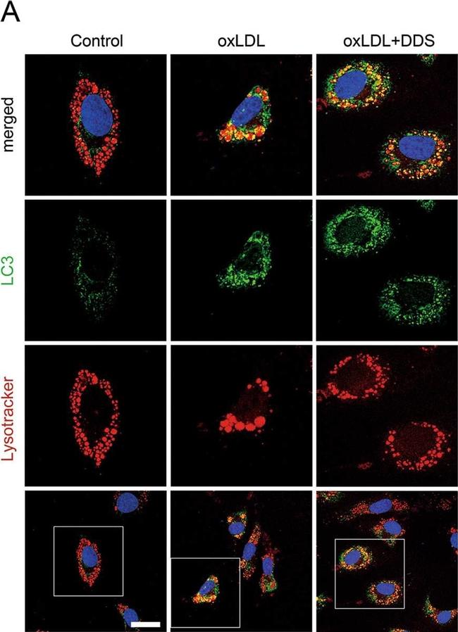 Rabbit IgG (H+L) Cross-Adsorbed Secondary Antibody in Immunocytochemistry (ICC/IF)