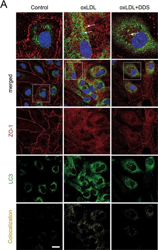 Rabbit IgG (H+L) Cross-Adsorbed Secondary Antibody in Immunocytochemistry (ICC/IF)