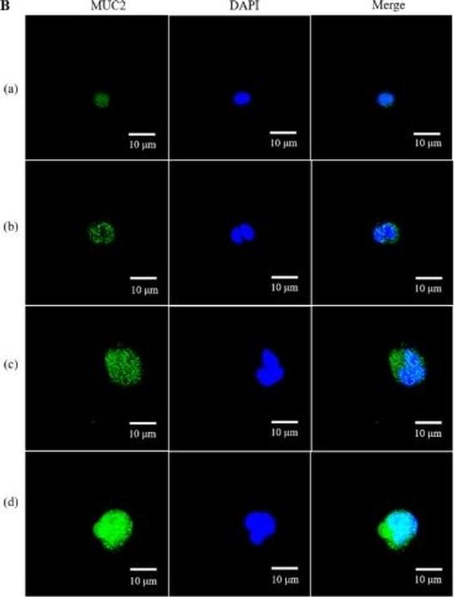 Rabbit IgG (H+L) Secondary Antibody in Immunocytochemistry (ICC/IF)