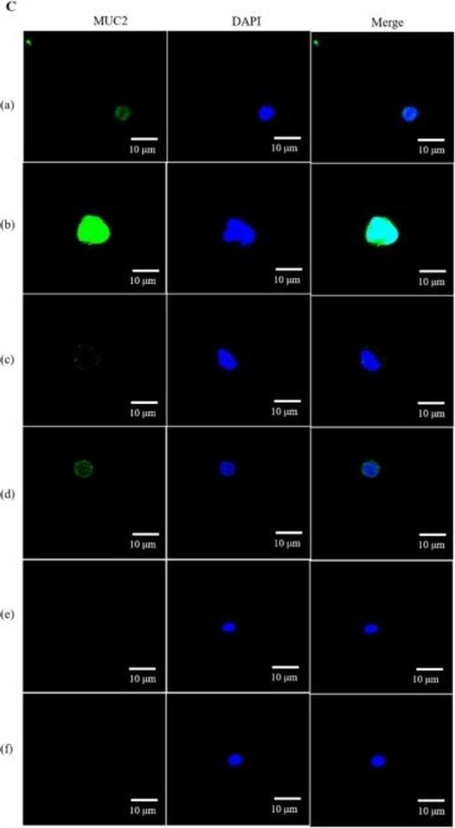 Rabbit IgG (H+L) Secondary Antibody in Immunocytochemistry (ICC/IF)