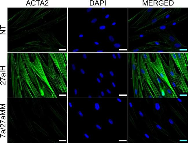 Rabbit IgG (H+L) Cross-Adsorbed Secondary Antibody in Immunocytochemistry (ICC/IF)