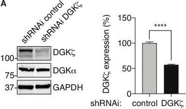 Rabbit IgG (H+L) Secondary Antibody in Western Blot (WB)