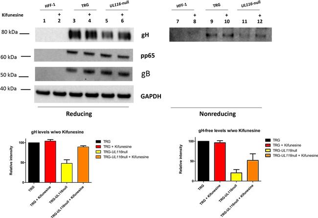 Mouse IgG (H+L) Secondary Antibody in Western Blot (WB)