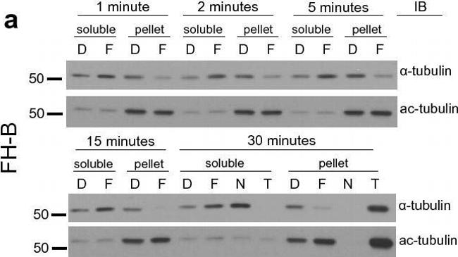 Rabbit IgG (H+L) Secondary Antibody in Western Blot (WB)