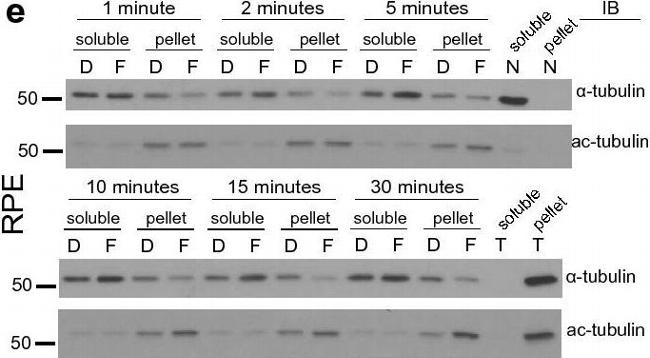 Rabbit IgG (H+L) Secondary Antibody in Western Blot (WB)