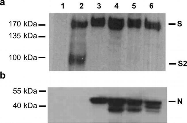 Rabbit IgG (H+L) Secondary Antibody in Western Blot (WB)