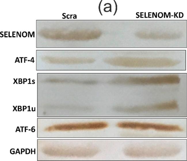 Rabbit IgG (H+L) Secondary Antibody in Western Blot (WB)