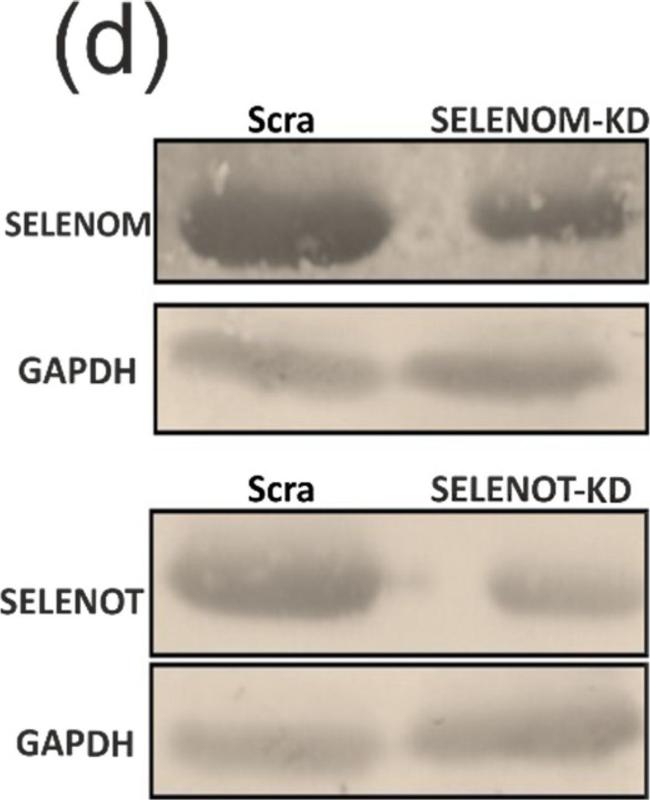 Rabbit IgG (H+L) Secondary Antibody in Western Blot (WB)