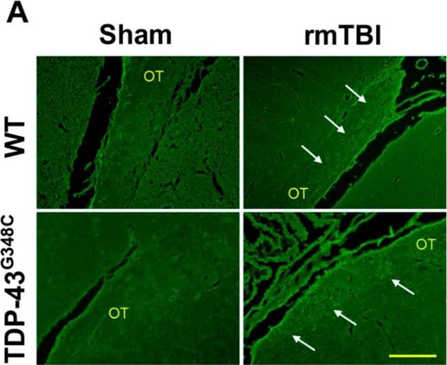 Rabbit IgG (H+L) Secondary Antibody in Immunohistochemistry (IHC)