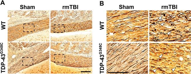 Rabbit IgG (H+L) Secondary Antibody in Immunohistochemistry (IHC)