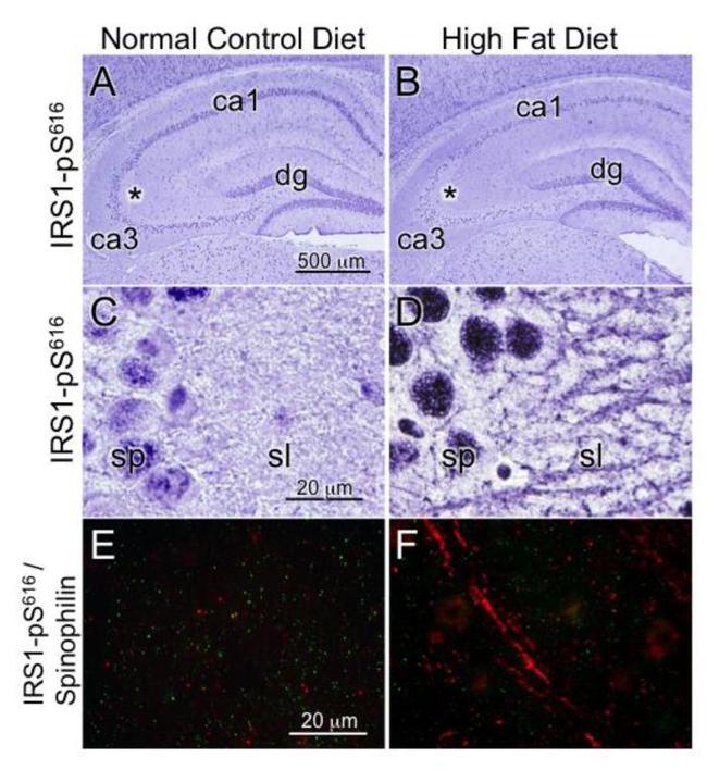 Phospho-IRS1 (Ser616) Antibody in Immunocytochemistry, Immunohistochemistry, Immunohistochemistry (Paraffin) (ICC/IF, IHC, IHC (P))