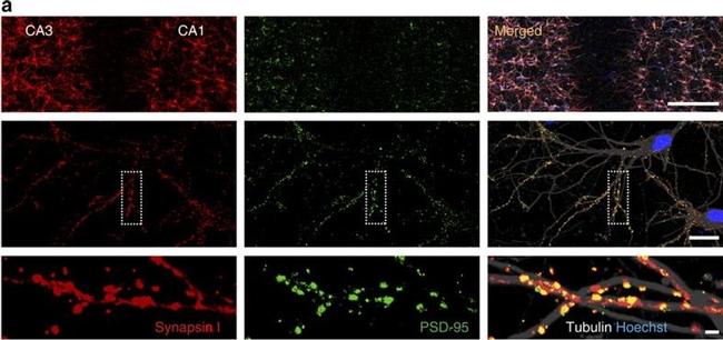 Rabbit IgG (H+L) Cross-Adsorbed Secondary Antibody in Immunocytochemistry (ICC/IF)