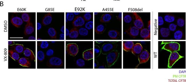 Mouse IgG (H+L) Cross-Adsorbed Secondary Antibody in Immunocytochemistry (ICC/IF)