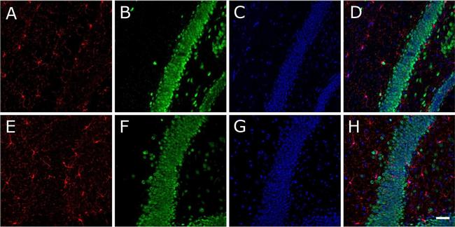 Rabbit IgG (H+L) Cross-Adsorbed Secondary Antibody in Immunohistochemistry (Frozen) (IHC (F))