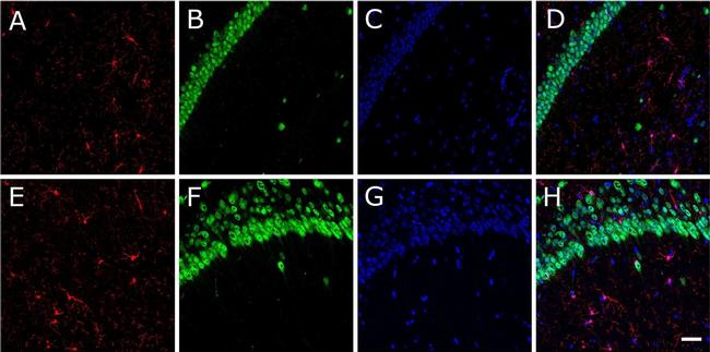 Rabbit IgG (H+L) Cross-Adsorbed Secondary Antibody in Immunohistochemistry (Frozen) (IHC (F))