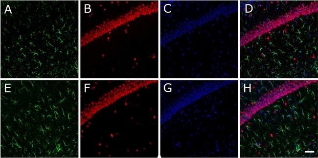 Rabbit IgG (H+L) Cross-Adsorbed Secondary Antibody in Immunohistochemistry (Frozen) (IHC (F))