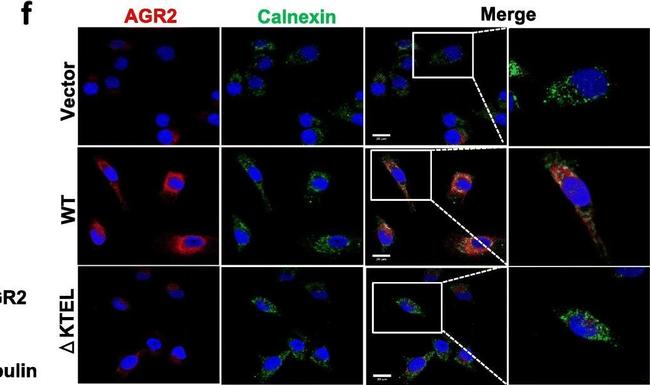 Mouse IgG (H+L) Cross-Adsorbed Secondary Antibody in Immunocytochemistry (ICC/IF)