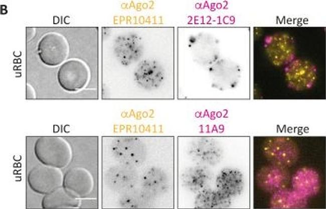 Mouse IgG (H+L) Highly Cross-Adsorbed Secondary Antibody in Immunocytochemistry (ICC/IF)