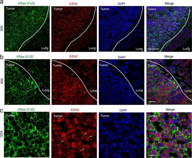 Rabbit IgG (H+L) Highly Cross-Adsorbed Secondary Antibody in Immunohistochemistry (IHC)