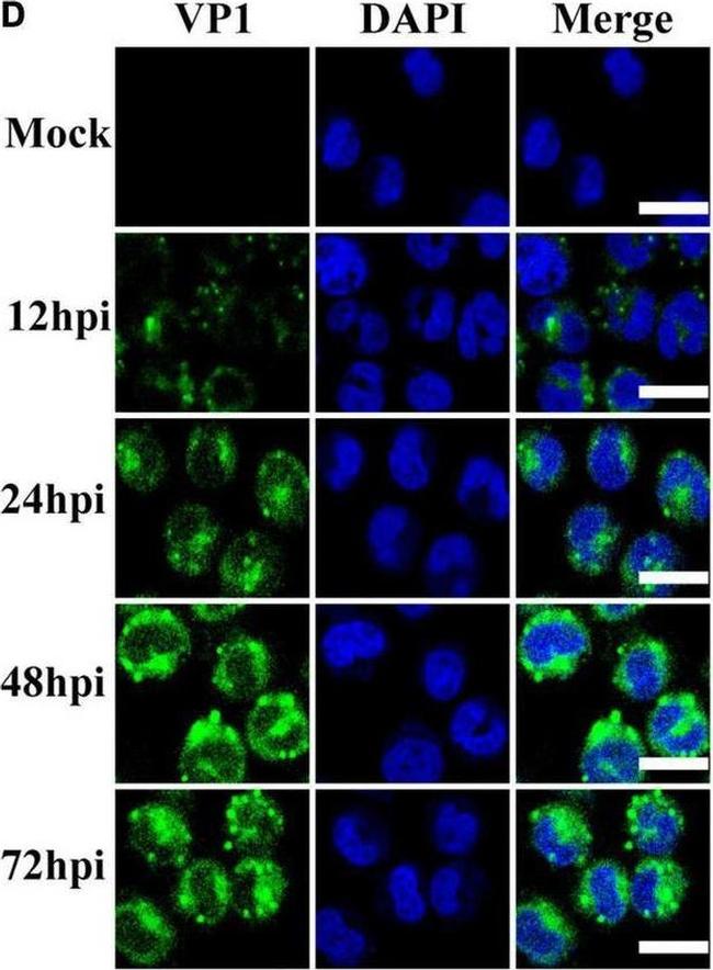 Rabbit IgG (H+L) Cross-Adsorbed Secondary Antibody in Immunocytochemistry (ICC/IF)