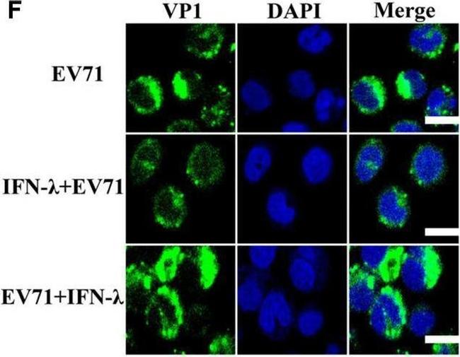 Rabbit IgG (H+L) Cross-Adsorbed Secondary Antibody in Immunocytochemistry (ICC/IF)