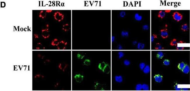 Rabbit IgG (H+L) Highly Cross-Adsorbed Secondary Antibody in Immunocytochemistry (ICC/IF)