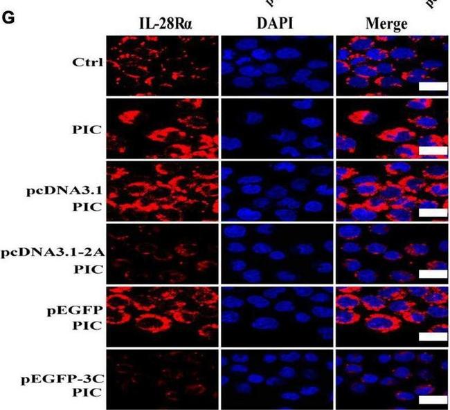 Rabbit IgG (H+L) Highly Cross-Adsorbed Secondary Antibody in Immunocytochemistry (ICC/IF)