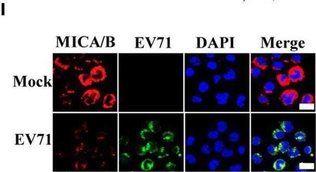 Rabbit IgG (H+L) Highly Cross-Adsorbed Secondary Antibody in Immunocytochemistry (ICC/IF)