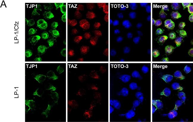 Rabbit IgG (H+L) Highly Cross-Adsorbed Secondary Antibody in Immunocytochemistry (ICC/IF)