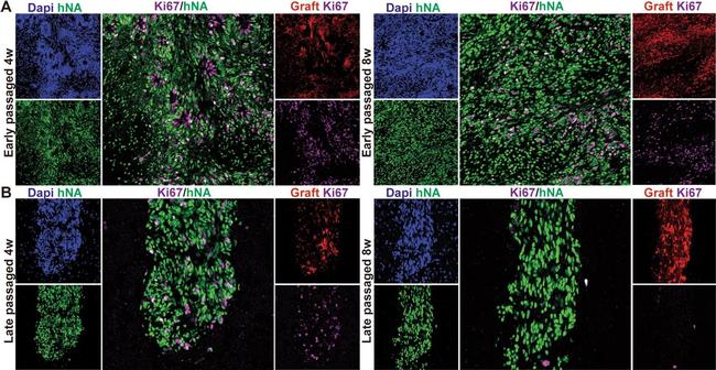 Rabbit IgG (H+L) Highly Cross-Adsorbed Secondary Antibody in Immunohistochemistry (IHC)